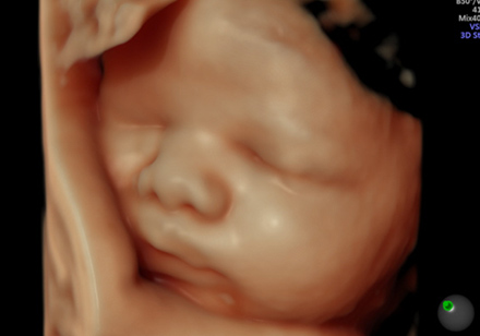 4D超音波外来でお腹の赤ちゃんのかわいい姿をご覧いただけます