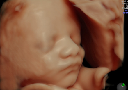 4D超音波外来でお腹の赤ちゃんのかわいい姿をご覧いただけます